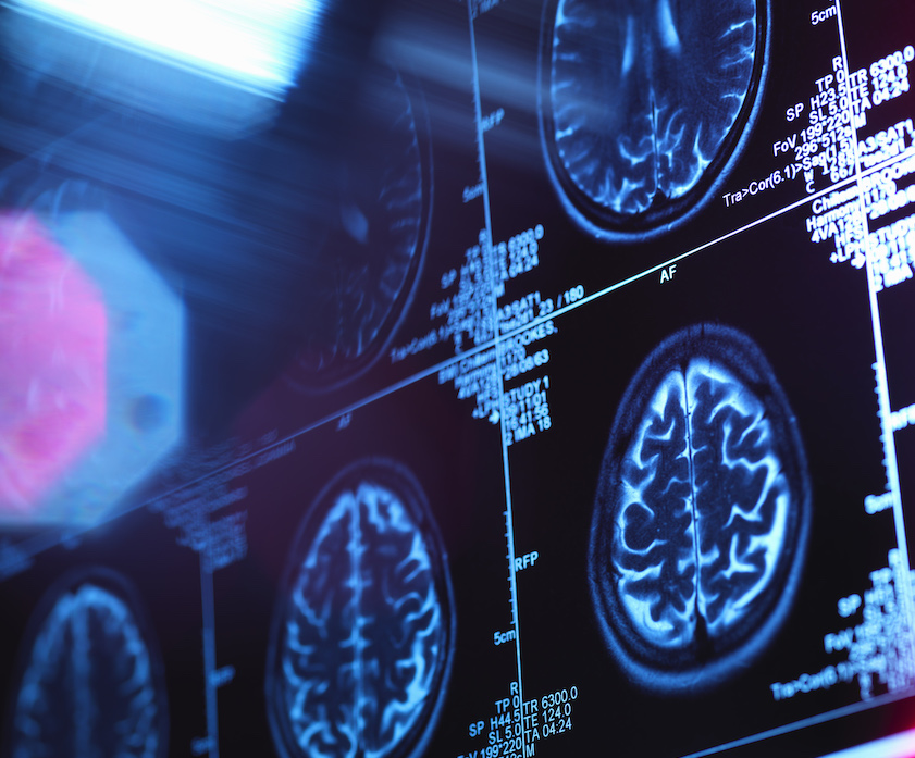 Brain imaging, cocoa flavanols and memory in older adults